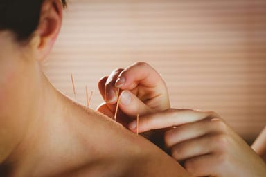 Tratamientos naturales para el dolor crónico: acupuntura y homeopatía como alternativas a medicamentos nocivos.