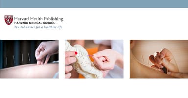 Imagen que ilustra los beneficios de la acupuntura para el dolor, según Harvard Health Publishing.
