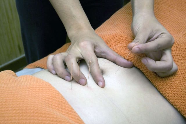 Alivio del dolor crónico con acupuntura para paciente de cáncer de tiroides con metástasis en vertebras y artritis