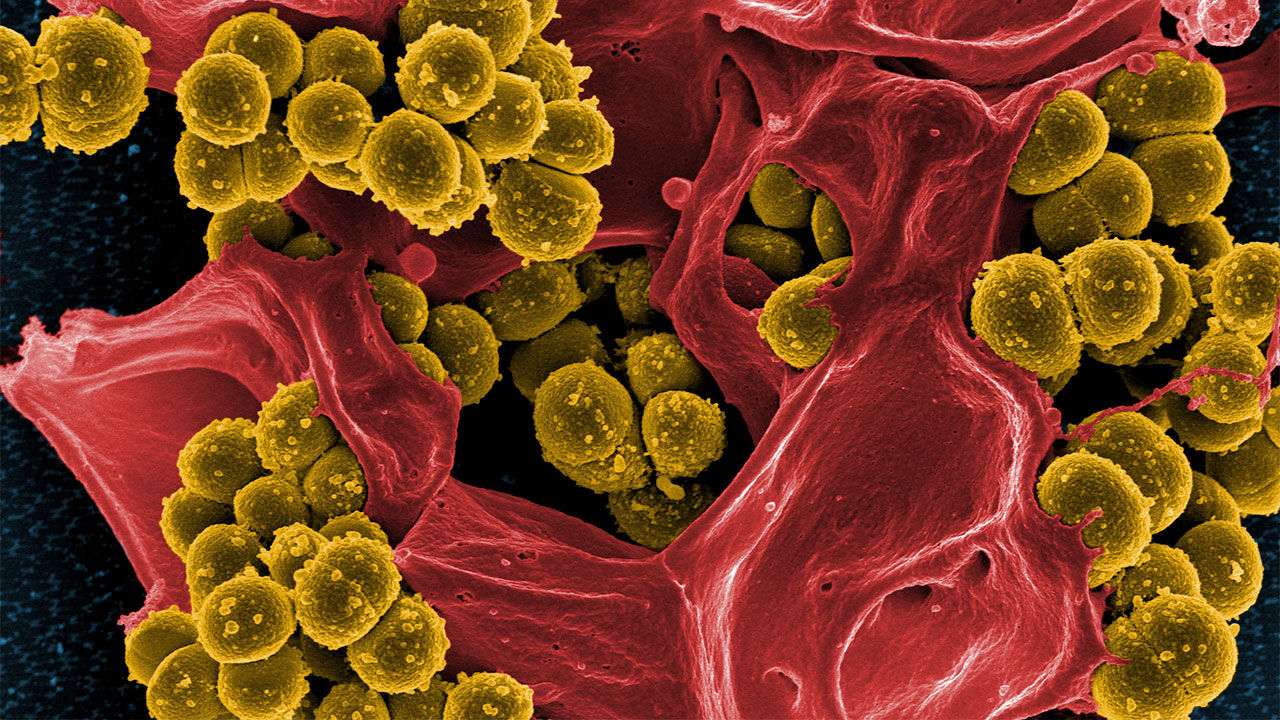 Cada vez que toma antibióticos, las bacterias sensibles mueren. Credito: NIAID